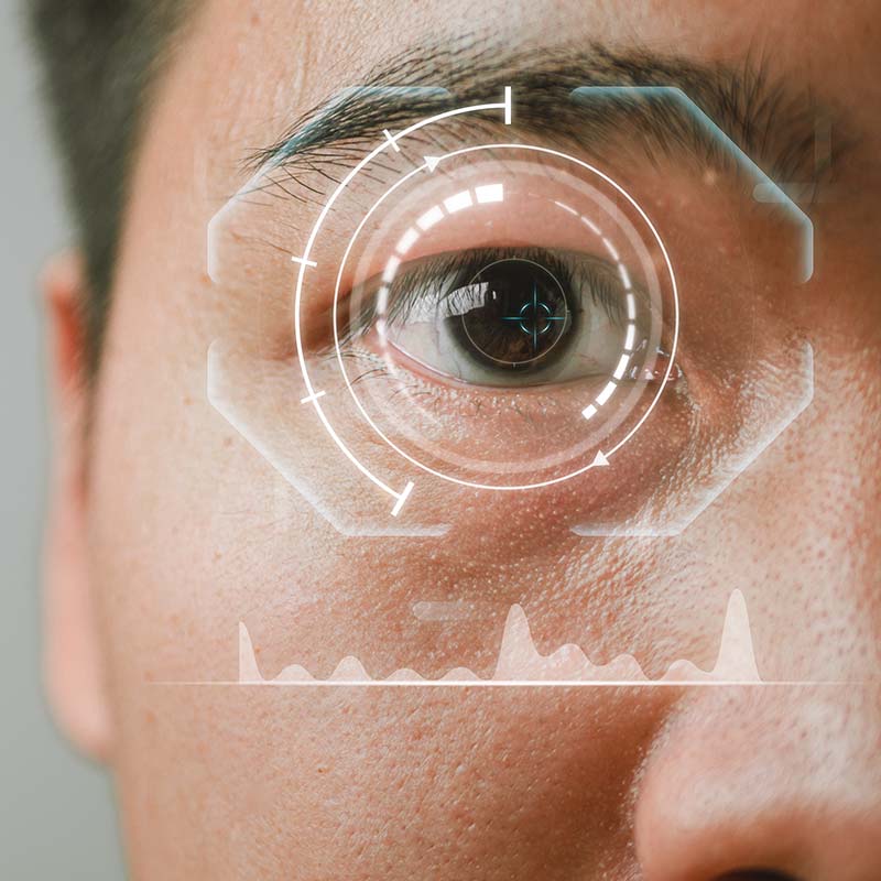 lasik